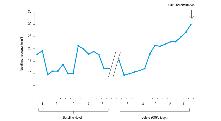 COPD_exacerbations_graph